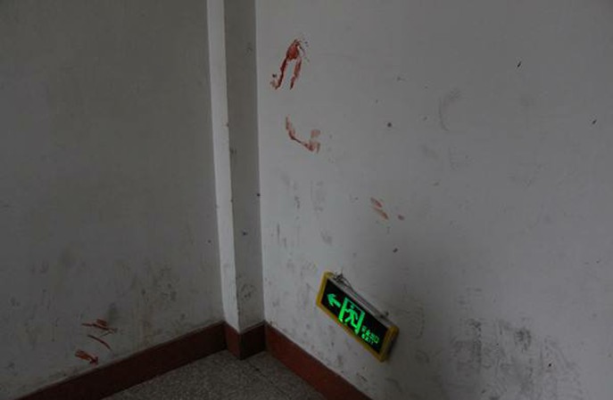 醫院牆麵血漬處理方法，新利平台官网專業靠譜更有效！