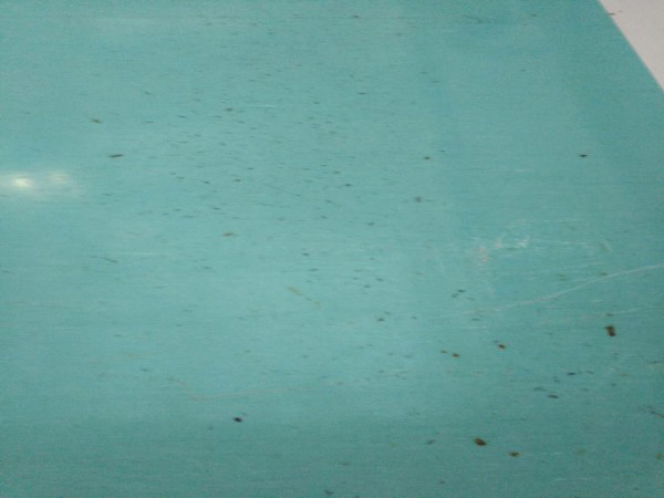 哈醫二院輸液室地麵煙頭燙傷(shang) 嚴(yan) 重 哈醫二院輸液室地麵煙頭燙傷(shang) 嚴(yan) 重